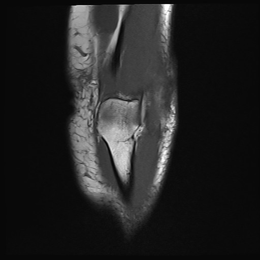 Click on the Serie image to view the images of Wieszt, Gnter